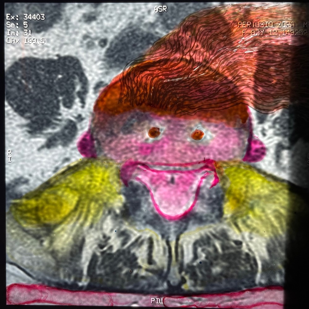 Devil In The Detail 1, 2023, Oil Paint on X-ray, L:48.5cm x W: 40.5cm