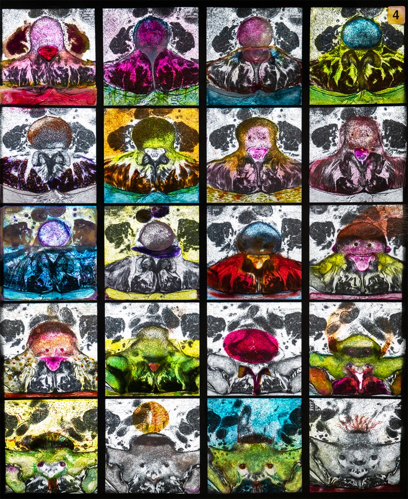 Devil In The Detail 1, 2023, Oil Paint on X-ray, L:48.5cm x W: 40.5cm