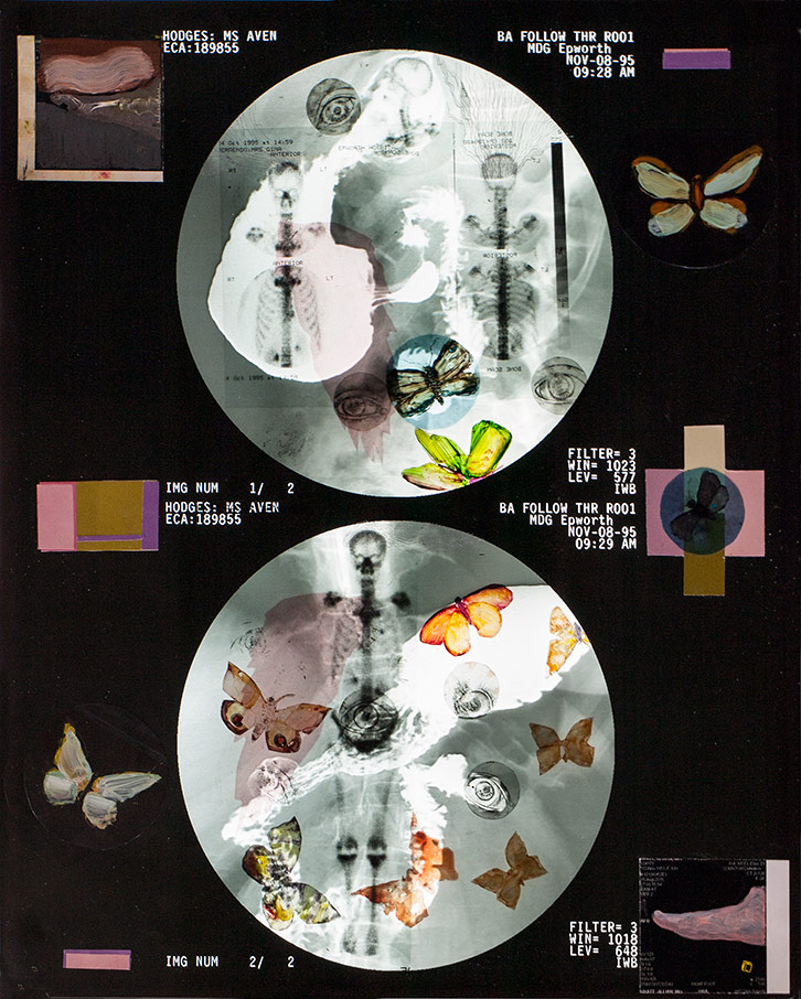 Moon Sightings, 2023, Oil Paint on X-Ray, L:49.5 x W:42cm