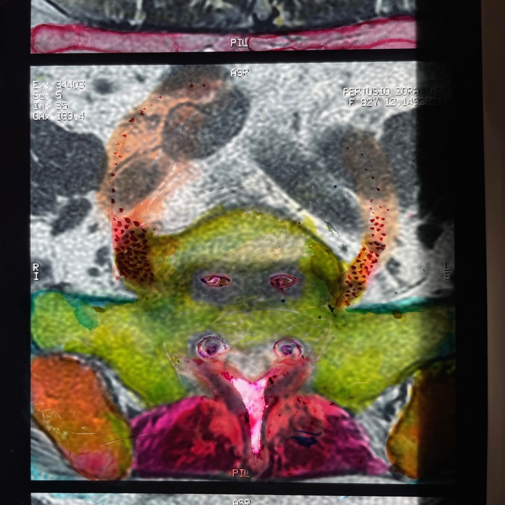 Devil In The Detail 1, 2023, Oil Paint on X-ray, L:48.5cm x W: 40.5cm