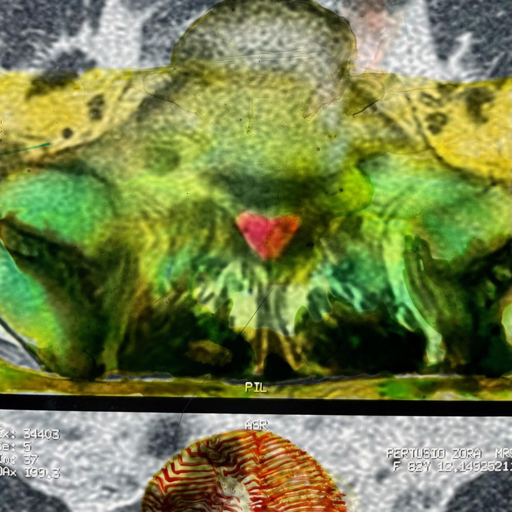 Devil In The Detail 1, 2023, Oil Paint on X-ray, L:48.5cm x W: 40.5cm