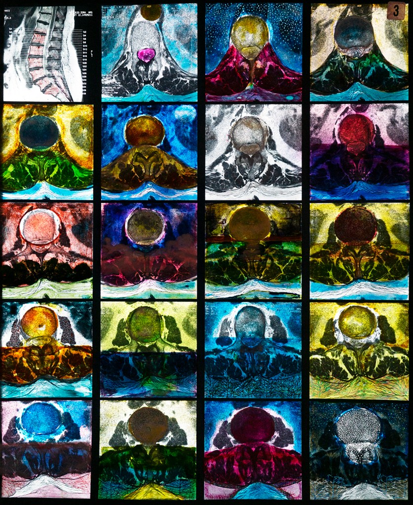 Moon Rise, 2020, Oil Paint on X-ray, L:48.5cm x W: 40.5cm