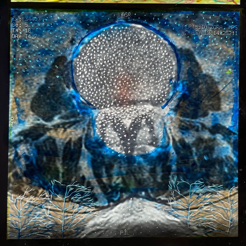 Moon Rise, 2020, Oil Paint on X-ray, L:48.5cm x W: 40.5cm