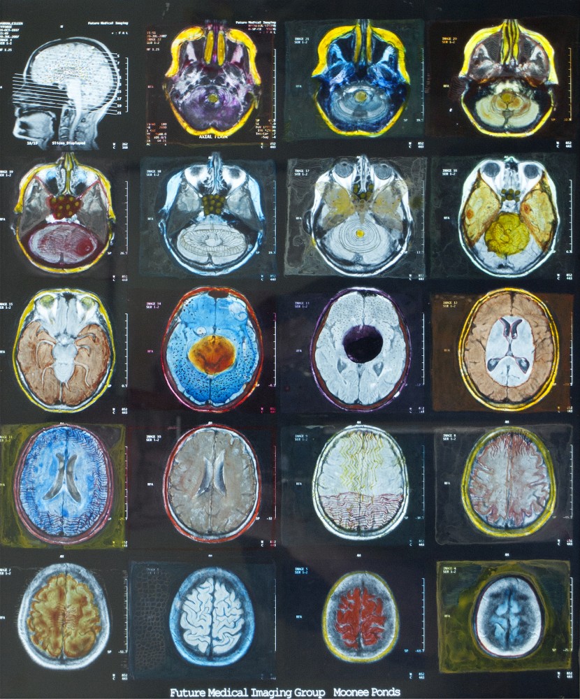 The Bug and The Butterfly, 2020, Oil paint on X-Ray, L:48.5cm x W: 40.5cm