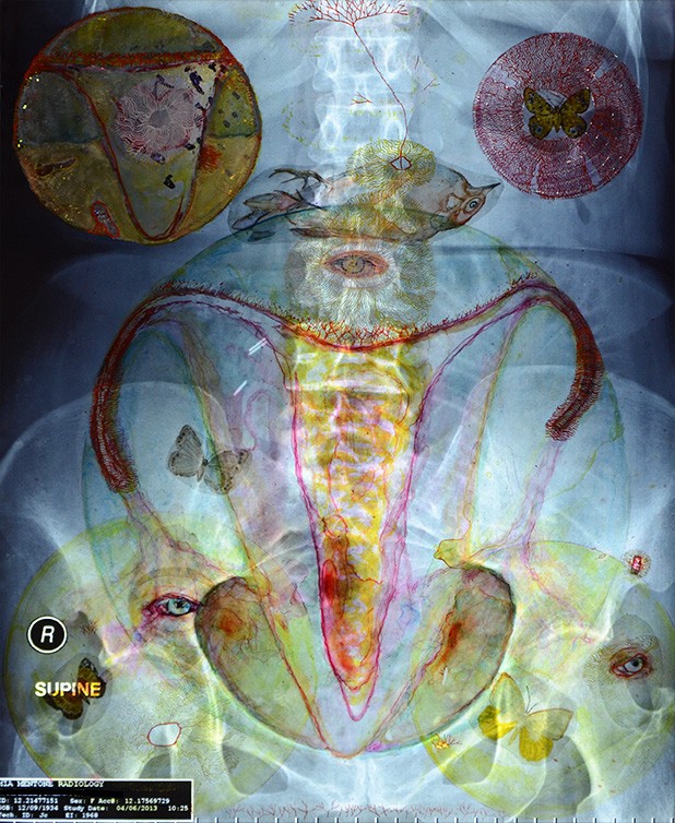 Transience  2016

water colour and Golden Acrylic On X-ray

L:48.5cm x W: 40.5cm