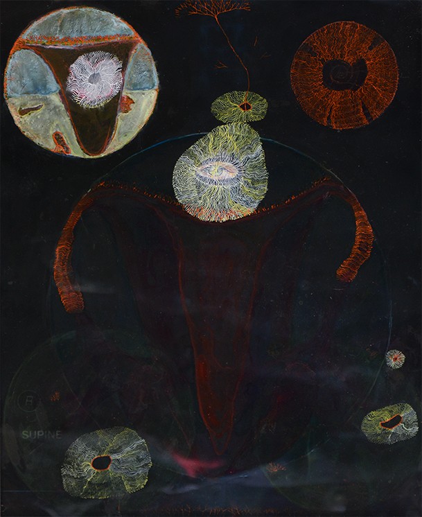 Transience 2016 water colour and Golden Acrylic On X-ray L:48.5cm x W: 40.5cm